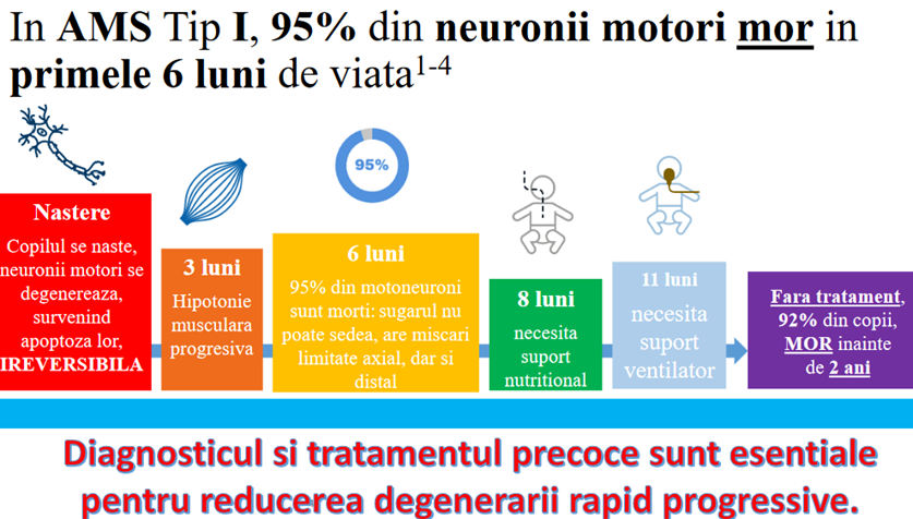 Diagnosticare AMS, amitrofia spinala